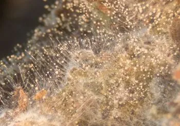 grzyb Aspergillus pod mikroskopem