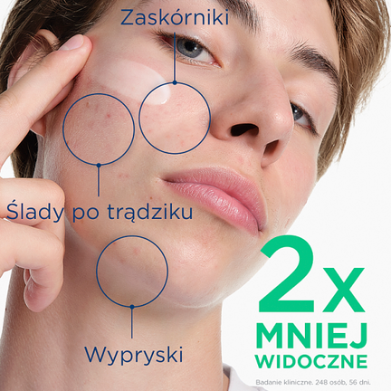 Bioderma Sebium Kerato+, Żel-Krem, 30 ml - KOSMETYK