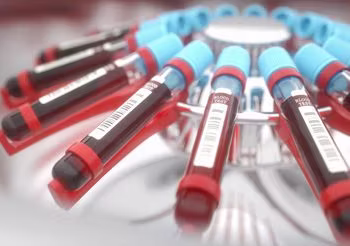 Kwasy żółciowe są końcowymi produktami degradacji cholesterolu, wytwarzanymi w wątrobie. Podstawowym zadaniem tych cząsteczek jest usprawnienie procesu trawienia i wchłaniania tłuszczy. /Fot. Adobe Stock