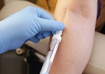 Gamma-globuliny to białka odpornościowe, do których zalicza się immunoglobuliny klasy IgA, IgM oraz IgG. /Fot. Adobe Stock