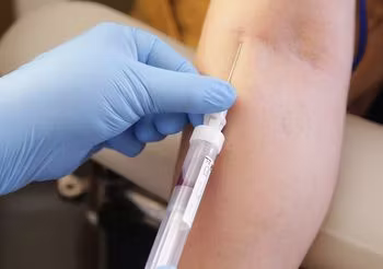 Gamma-globuliny to białka odpornościowe, do których zalicza się immunoglobuliny klasy IgA, IgM oraz IgG. /Fot. Adobe Stock