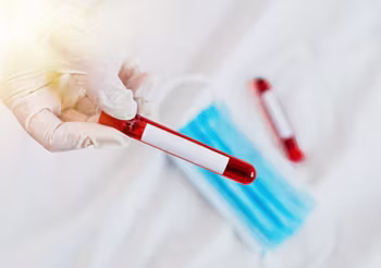 Ceruloplazmina zaliczana jest do tzw. białek fazy ostrej co oznacza, że jej zwiększona produkcja następuje na skutek stanu zapalnego w organizmie. /Fot. Adobe Stock