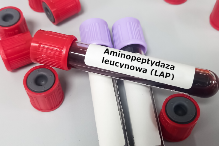 Aminopeptydaza Leucynowa Lap — Na Czym Polega Badanie I Kiedy Je Wykonać Przygotowanie Normy 6340
