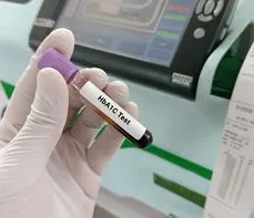 Oznaczenie hemoglobiny glikowanej (HbA1C) – na czym polega badanie? Normy, wskazania, przygotowanie