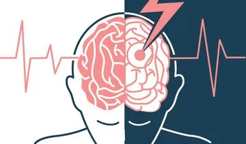 Udar mózgu – objawy udaru niedokrwiennego i krwotocznego (wylewu). Pierwsza pomoc przy udarze