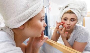 Trądzik pospolity - objawy i leczenie. Jaką dietę stosować?