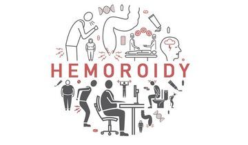 Hemoroidy – objawy, przyczyny, leki na hemoroidy