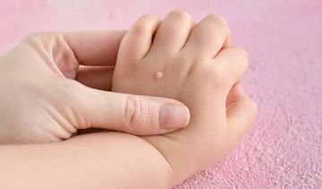 Preparaty na kurzajki