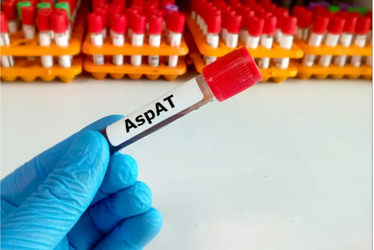 Aminotransferaza asparaginianowa (AspAT) to enzym występujący w komórkach większości tkanek w organizmie człowieka. /Fot. Adobe Stock