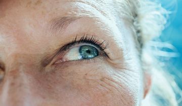 Przebarwienia posłoneczne − jak z nimi skutecznie walczyć