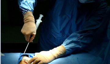 Autoprzeszczep szpiku ratuje życie. Za zabieg płaci Narodowy Fundusz Zdrowia