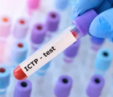 C-końcowy telopeptyd kolagenu typu I (ICTP) – co to za badanie? Normy, wskazania, przygotowanie
