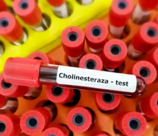 Cholinesteraza – na czym polega badanie? Normy, wskazania, przygotowanie