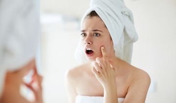 Trądzik u dorosłych − przyczyny, leczenie i pielęgnacja cery trądzikowej