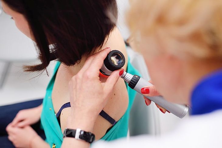dermatolog bada pieprzyk za pomocą dermatoskopu