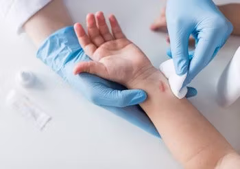 Ziarninowanie to początek gojenia się rany. Na skórze powstaje ziarnina, czyli pierwsza warstwa ochronna.