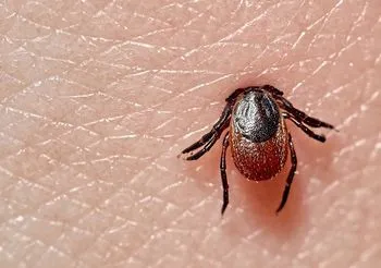 Pozostawienie kleszcza w skórze naraża nas na ryzyko uwolnienia toksycznych substancji do organizmu / Fot. Adobe Stock