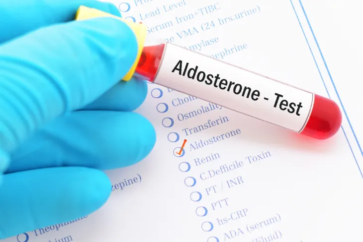 Aldosteron to hormon steroidowy produkowany przez nadnercza. Jego główną funkcją jest regulacja gospodarki wodno-mineralnej w organizmie. /Fot. Adobe Stock