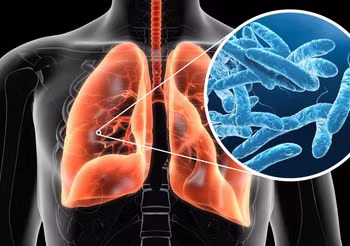 Bakterie Legionella wywołują legionelozę. Jedną z postaci tej choroby jest bardzo niebezpieczna infekcja płuc, zwana chorobą legionistów.