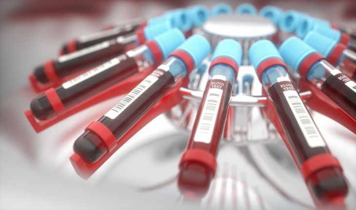 Kwasy żółciowe są końcowymi produktami degradacji cholesterolu, wytwarzanymi w wątrobie. Podstawowym zadaniem tych cząsteczek jest usprawnienie procesu trawienia i wchłaniania tłuszczy. /Fot. Adobe Stock