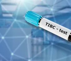 Całkowita zdolność surowicy do wiązania żelaza (TIBC) – co to za badanie?