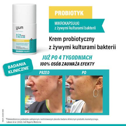 Yun Acn Repair krem probiotyczny do twarzy, 50 ml - BAUSCH HEALTH