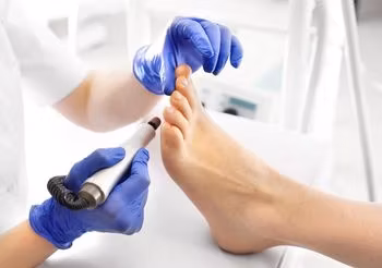 Modzele i odciski (lub nagniotki) to miejscowe zgrubienia skóry zwykle wywołane długotrwałym uciskiem, tarciem. Możemy się ich pozbyć u podologa lub w domu.