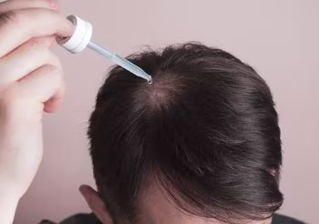 Na wypadanie włosów stosuje się nie tylko szampony i odżywki, lecz także wcierki, lotiony czy ampułki. Fot. Adobe Stock.