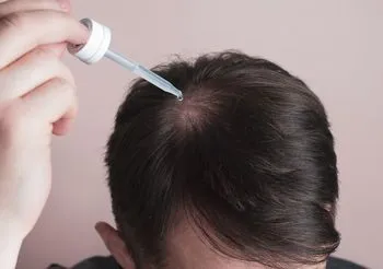 Na wypadanie włosów stosuje się nie tylko szampony i odżywki, lecz także wcierki, lotiony czy ampułki. Fot. Adobe Stock.
