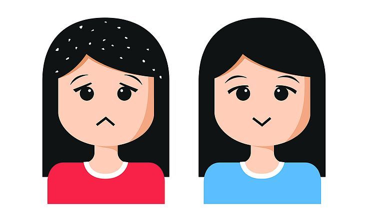 Grafika przedstawiająca smutną dziewczyną z widocznym łupieżem i uśmiechnietą bez łupieżu.