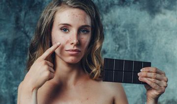 Dieta przy trądziku młodzieńczym − podstawowe zalecenia żywieniowe