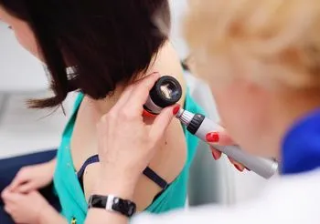 dermatolog bada pieprzyk za pomocą dermatoskopu