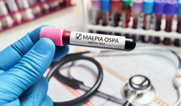 Czy małpia ospa jest groźna? Wirus dotarł do Polski