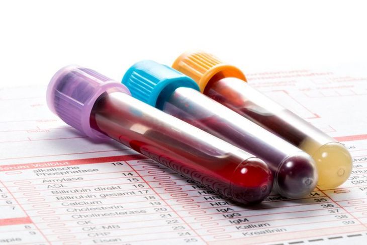 Próbówki laboratoryjne napełnione krwią 