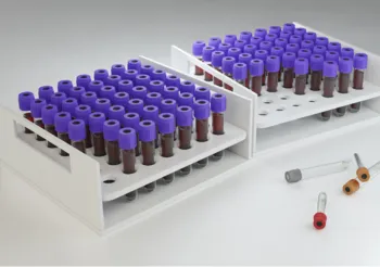 CEA, czyli inaczej antygen rakowo-płodowy, to substancja należąca do tzw. glikoprotein /Fot. Adobe Stock