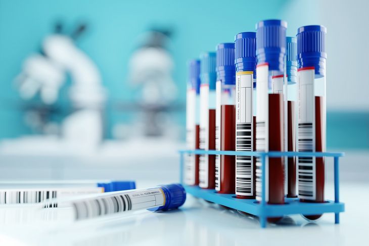 IGF-1, czyli isulinopodobny czynnik wzrostu, jest tzw. hormonem peptydowym, którego synteza odbywa się w wątrobie / Fot. Adobe Stock