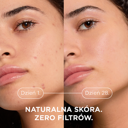 Bioderma Sebium Kerato+, Żel-Krem, 30 ml - KREM