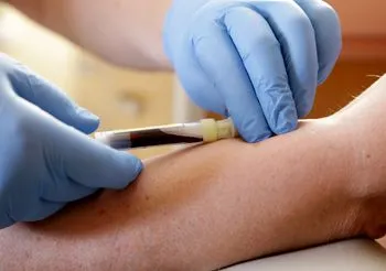 Badanie glukozy we krwi jest jednym z najczęściej wykonywanych badań profilaktycznych, na które warto udać się minimum raz w roku. /Fot. Adobe Stock