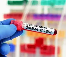Enzym gamma-glutamylotranspeptydaza (GGTP) – na czym polega badanie? Normy, wskazania, przygotowanie