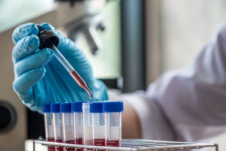 Test na obecność wirusa HIV polega na oznaczeniu we krwi pacjenta obecności przeciwciał przeciwko wirusowi HIV oraz odpowiednich antygenów. Badania wykonywane są z próbki krwi żylnej pobranej w laboratorium. Fot. Adobe Stock.