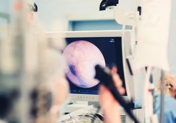 Raka jelita grubego można wykryć przede wszystkim dzięki kolonoskopii.