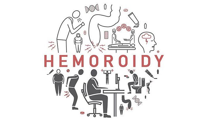 hemoroidy - grafika