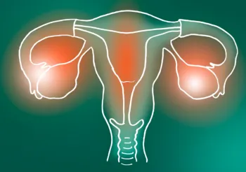 Badanie HSG, inaczej histerosalpingografia, to specjalistyczne badanie radiologiczne jajowodów i macicy. /Fot. Adobe Stock