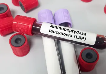 Aminopeptydaza leucynowa (LAP) to enzym występujący w komórkach wątroby, przewodów żółciowych oraz trzustce i nabłonku jelit. /Fot. Adobe Stock