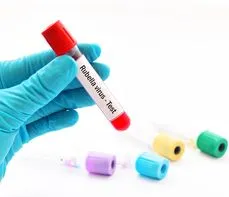Przeciwciała IgM Różyczka (Rubella virus) – na czym polega badanie? Normy, wskazania, przygotowanie