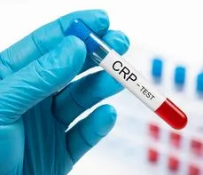 CRP, czyli białko C-reaktywne – co to jest, kiedy wykonywać badania CRP i co oznaczają przekroczone normy?