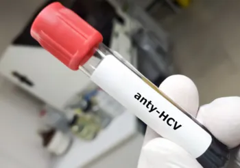 Anty-HCV to przeciwciała przeciwko wirusowemu zapaleniu wątroby typu C obecne we krwi osób mających w przeszłości kontakt z wirusem. /Fot. Adobe Stock