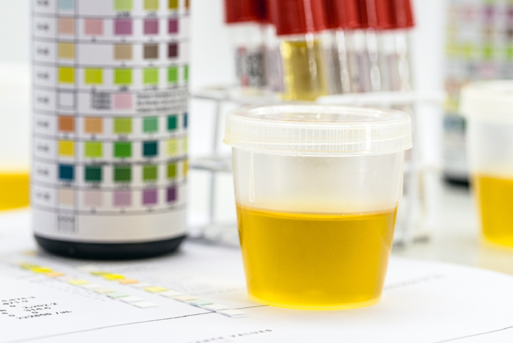 Ciała ketonowe powstają jako produkt pośredni metabolizmu komórek tłuszczowych. /Fot. Adobe Stock