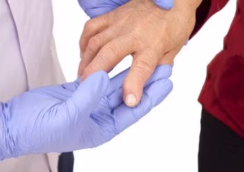 guzki reumatoidalne - badanie guzków reumatoidalnych u lekarza