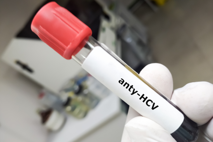 Anty-HCV to przeciwciała przeciwko wirusowemu zapaleniu wątroby typu C obecne we krwi osób mających w przeszłości kontakt z wirusem. /Fot. Adobe Stock